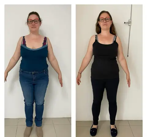 Avant, après, de face, le montage photo d’une membre d’Aloha Nutriclub