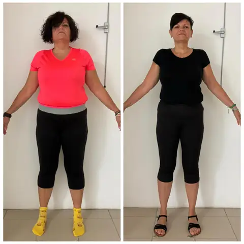 Avant, après, de face, le montage photo d’une membre d’Aloha Nutriclub