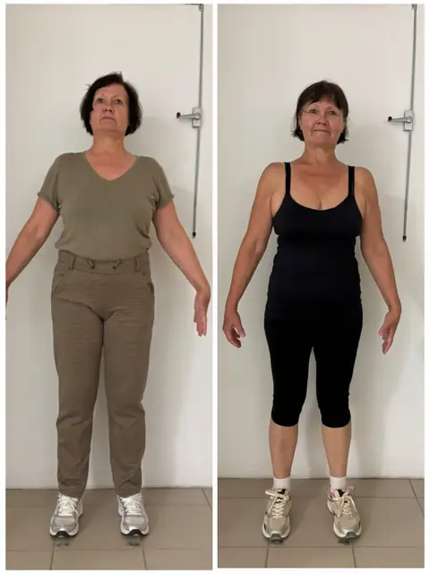 Avant, après, de face, le montage photo d’une membre d’Aloha Nutriclub